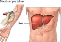 Elevated Liver Functions Life Insurance