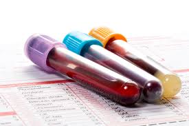 Life Insurance Blood Test FAQ